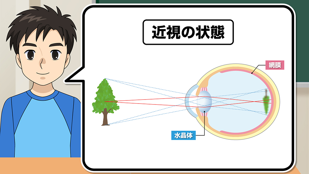 広島県教科用図書販売、近視の仕組みと予防を学ぶ動画を公開 - こどもとIT